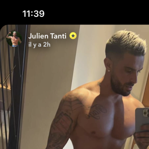 Julien Tanti dévoile l'extraordinaire avant/après de sa liposuccion sur Snapchat.