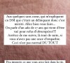 "Aux quelques sans coeur, qui m'expliquent en messages privés que c'était un délinquant donc c'est mérité. Allez bien vous faire...", lâche ensuite Clémentine Sarlat