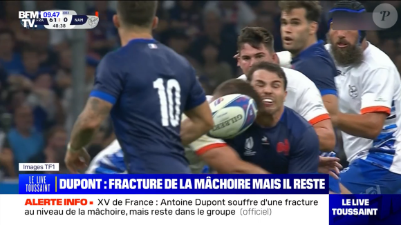 Pour rappel, il a été victime d'une fracture à la mâchoire.
Images chocs et nouvelles d'Antoine Dupont après sa blessure contre la Namibie, "BFMTV".