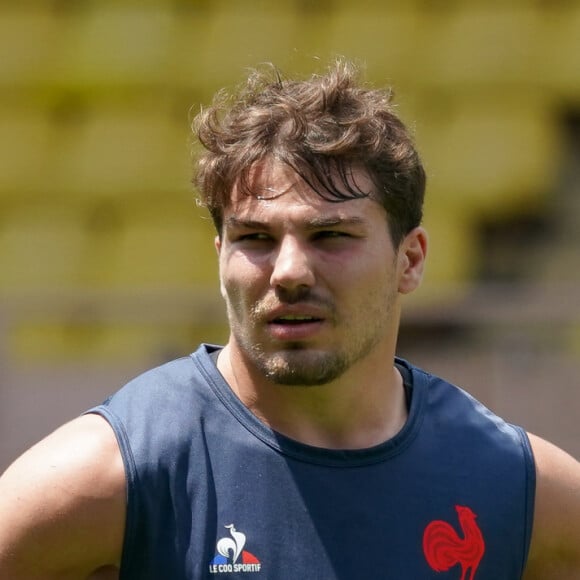 L'occasion de voir le gros coquard qu'il a au niveau de l'oeil droit.
Antoine Dupont (France) - Stage de l'équipe de France de rugby à Monaco, le 4 juillet 2023. © Norbert Scanella/Panoramic/Bestimage