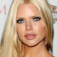 Sophie Monk : "La chirurgie esthétique, j'aurais dû dire non dès le début..."