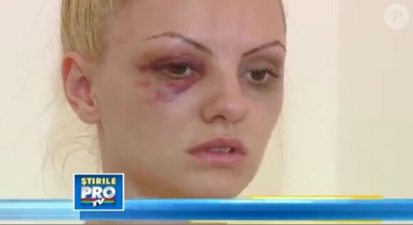 La chanteuse Alexandra Stan raconte le 15 juin 2013 l'agression dont elle a été victime par son manager à la télévision roumaine.
