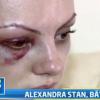 Alexandra Stan raconte le 15 juin 2013 l'agression dont elle a été victime par son manager à la télévision roumaine.