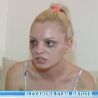 Alexandra Stan, le visage tuméfié et en larmes : Son manager l'aurait tabassée !