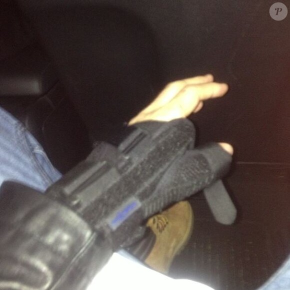 M. Pokora a posté un cliché de sa main dont il a le pouce blessé, sur Instagram, le 12 novembre 2013.