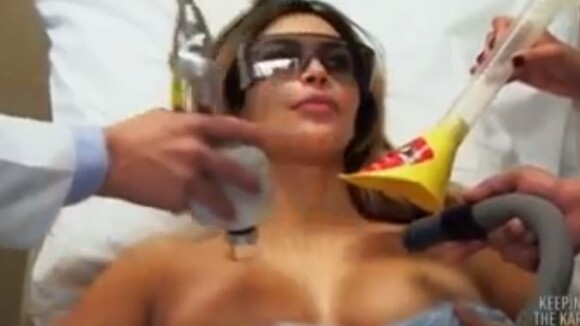 Kim Kardashian : Intervention au laser sur sa poitrine pour être impeccable