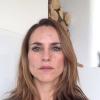 Carole Dechantre a dévoilé qu'elle était atteinte d'un cancer de la peau sur son compte Facebook. Cette photo était jointe à l'annonce. Février 2014.