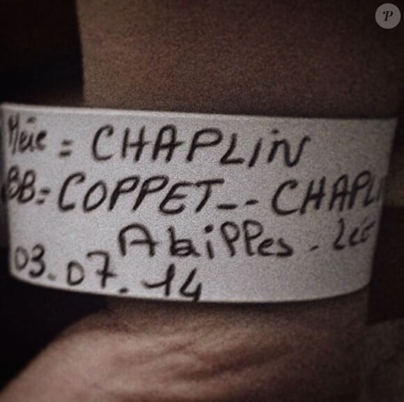 Stany Coppet a posté cette photo du poignet de son fils Akilles-Léo, le 5 juillet 2014.