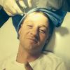 L'acteur Benjamin McKenzie montre sa blessure sur le tournage de sa série "Gotham" le 12 septembre 2014.