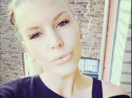 Amélie Neten : Son visage transformé par la chirurgie esthétique ?