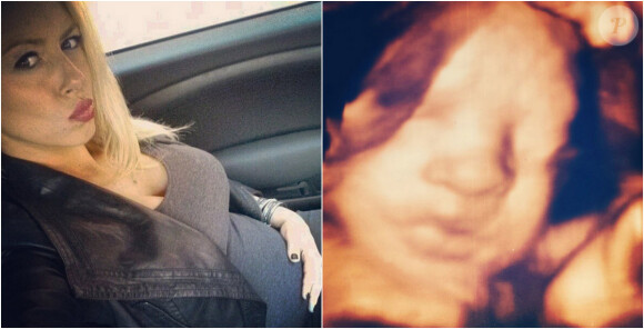 Enceinte de 29 semaines, Stephanie (Secret Story 4) dévoile le visage de son futur bébé grâce à une échographie 3D. Une jolie photo postée le 1er décembre 2014 sur Instagram.