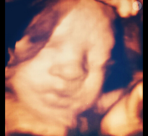 Stéphanie Clerbois dévoile le visage de son bébé à 29 semaines de grossesse. Novembre 2014.