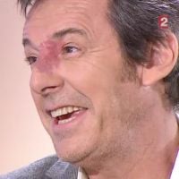 Jean-Luc Reichmann, surnommée 'La tache' à l'école : 'Je resterai ainsi'