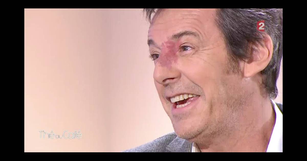 Jean-Luc Reichmann, surnommée 'La tache' à l'école : 'Je resterai ainsi