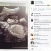 Photo de l'échographie du mannequin américain Sarah Stage, enceinte de 8 mois - 2015