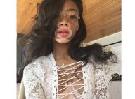 Chantelle Winnie : Malade et différente, elle est le nouveau top en vogue !