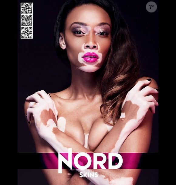 Chantelle Winnie en couverture de Nord Skins magazine
