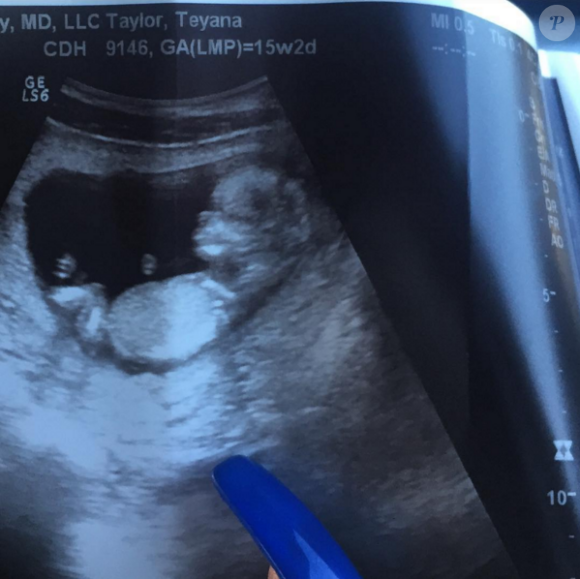 Iman Shumpert des Cleveland Cavaliers et la chanteuse Teyana Taylor vont avoir leur premier enfant en janvier 2016. Photo Instagram de l'échographie, en septembre 2015.