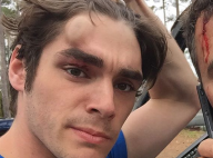 RJ Mitte (Breaking Bad), victime d'un accident : Le beau gosse bien amoché