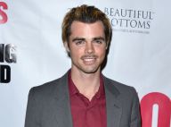 Reid Ewing (Modern Family) : L'acteur accro à la chirurgie poussé au coming out