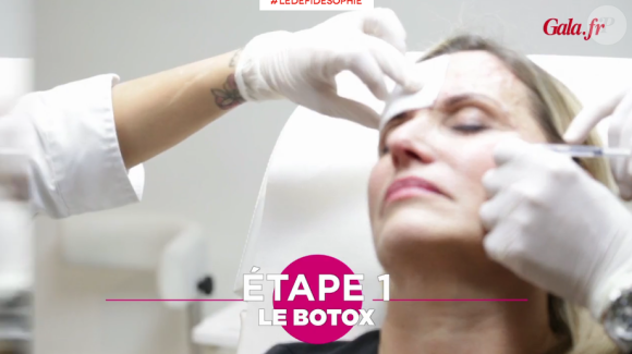 Sophie Favier se lance dans l'expérimentation du botox et du CoolSculpting pour Le Défi de Sophie avec Gala. Ici, place au botox !