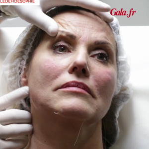 Sophie Favier se lance dans l'expérimentation du botox et du CoolSculpting pour Le Défi de Sophie avec Gala. Ici, place au botox !