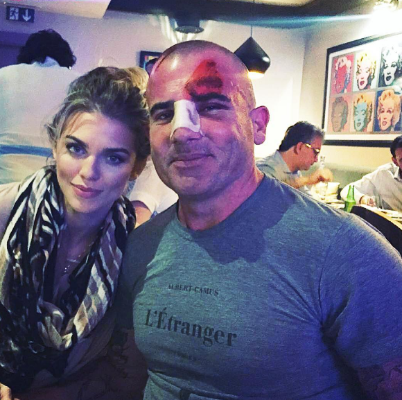 Dominic Purcell et sa compagne AnnaLynne McCord après l'accident de l'acteur. Photo publiée sur Instagram, le 10 juin 2016