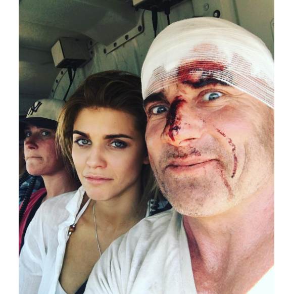 Dominic Purcell a été victime d'un grave accident de plateau sur le tournage de la série Prison Break. Sa petite amie AnnaLynne McCord était à ses côtés. Photo publiée sur Instagram au début du mois de juin 2016