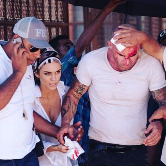 Dominic Purcell a été victime d'un grave accident de plateau sur le tournage de la série Prison Break. Sa petite amie AnnaLynne McCord était à ses côtés. Photo publiée sur Instagram au début du mois de juin 2016