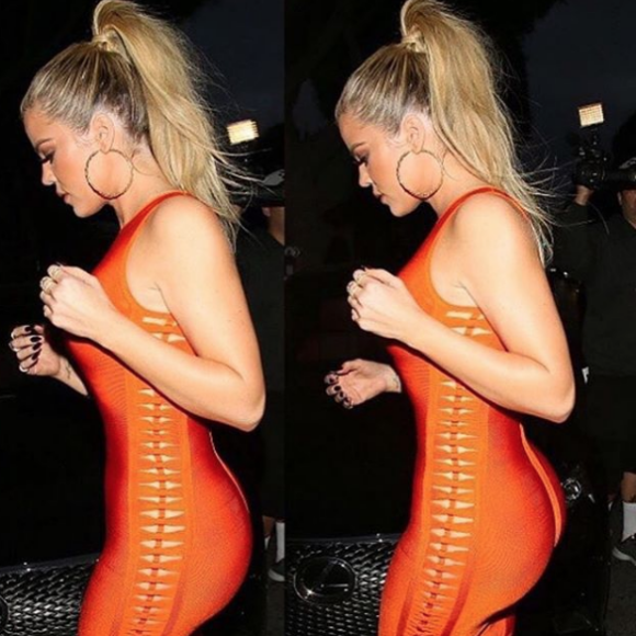Khloé Kardahsian : Ses fesses de rêve sont-elles naturelles ?