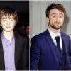 Daniel Radcliffe à New York en 2001 / Daniel Radcliffe en 2015 à Londres.