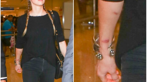 Amber Heard : Après la fuite de sa vidéo, elle dévoile un bras couvert de bleus...