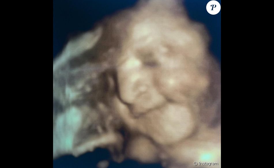 Le Bebe D Emanuel Mammana Et Sa Compagne Magui En 3d Purepeople