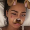 Leigh-Anne Pinnock, la chanteuse des Little Mix a publié une photo de son visage tuméfié après qu'un client dans un restaurant lui a mis une gifle. photo publiée sur son compte Snapchat. L'incident se serait produit le 28 novembre 2016