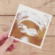 Lauren Conrad annonce sa grossesse sur sa page Instagram où elle a publié une photo de son échographie, le 1er janvier 2016