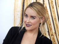 Lauren Conrad enceinte : La star dévoile la première échographie de son bébé