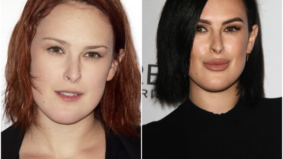 Rumer Willis : Les lèvres gonflées, elle a cédé à l'appel des injections !