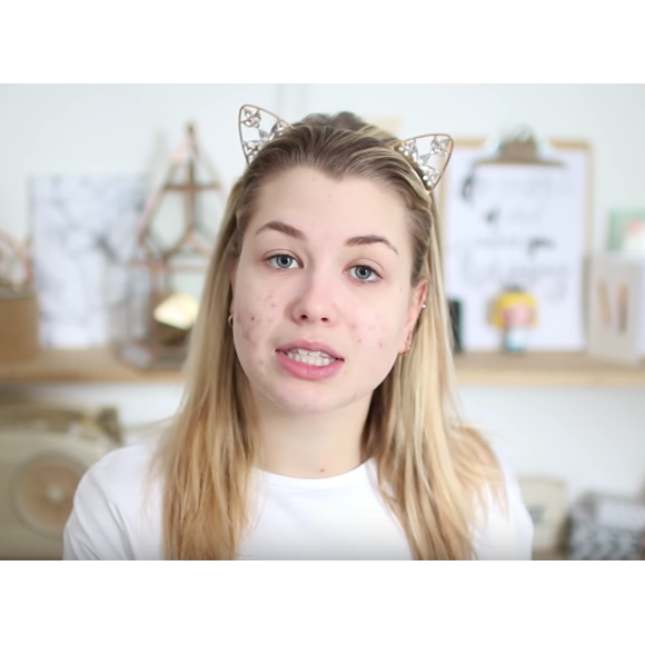 EnjoyPhoenix sans maquillage : Son avant/après très impressionnant ! Février 2017.