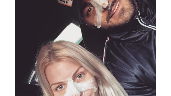 Jessica Thivenin et Thibault Kuro amoureux : Ils font une rhinoplastie chacun !