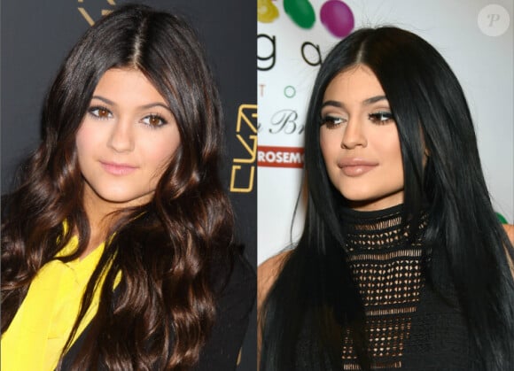 Kylie Jenner en 2012 et en 2015. La star de 17 ans a admis avoir eu recours à des injections pour augmenter le volume de ses lèvres.