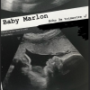 Caroline Receveur dévoile l'échographie de son bébé, Marlon, le 11 mai 2018.