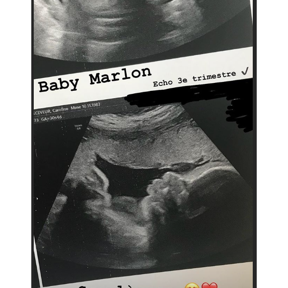 Caroline Receveur dévoile l'échographie de son bébé, Marlon, le 11 mai 2018.
