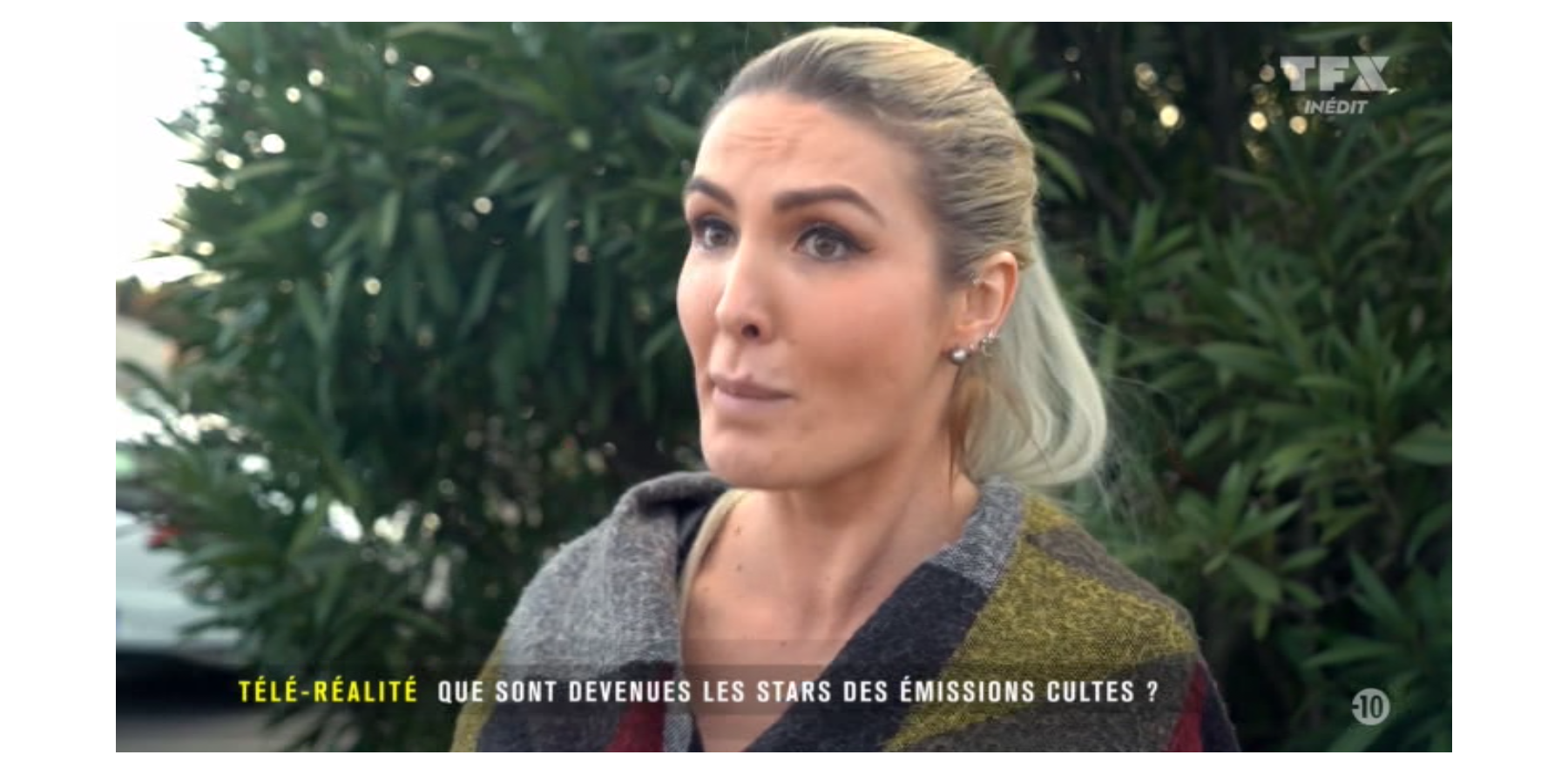 Marie De Secret Story Accident Marie Garet (Secret Story) défigurée : "J'aurais préféré être morte et  belle" - Purepeople