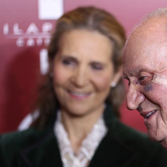 Le roi Juan Carlos Ier d'Espagne, marqué au visage en raison d'une récente intervention chirurgicale, assistait le 22 mars 2019 en compagnie de sa fille l'infante Elena au gala de présentation de la prochaine Feria de San Isidro, aux arènes de Las Ventas à Madrid.
