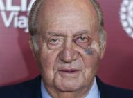 Juan Carlos Ier : L'oeil au beurre noir mais ravi avec Elena et ses enfants