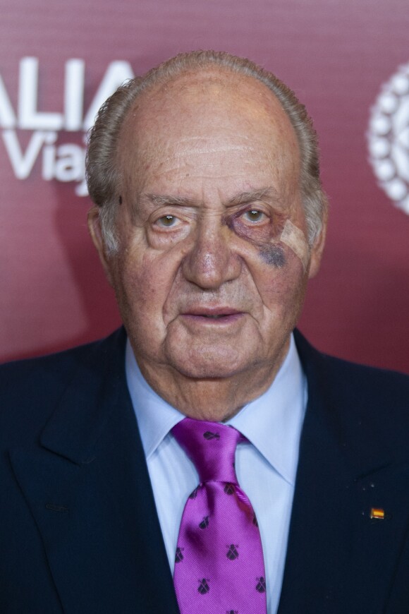 Le roi Juan Carlos Ier d'Espagne, marqué au visage en raison d'une récente intervention chirurgicale, assistait le 22 mars 2019 au gala de présentation de la prochaine Feria de San Isidro, aux arènes de Las Ventas à Madrid.