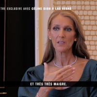 Céline Dion et ses problèmes de dents : "Devenir égérie, c'est un miracle !"