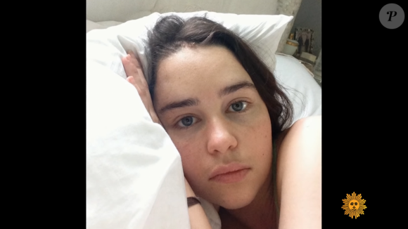 Emilia Clarke se confie sur ses deux AVC pour CBS, le 7 avril 2019.