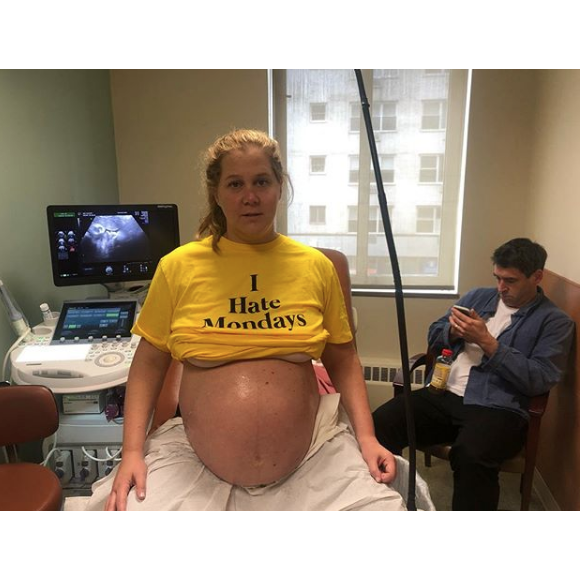 Amy Schumer sur Instagram.