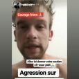 Théophile Renier, candidat de "The Voice 8" (TF1), a été sauvagement agressé comme il l'a raconté lundi 24 juin 2019 sur Instagram.